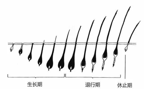 脱发问题