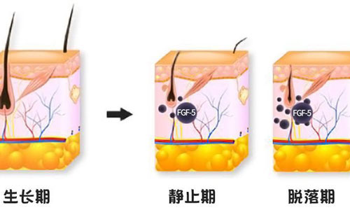 广州植发脱落期后的头发还能够长出来吗？