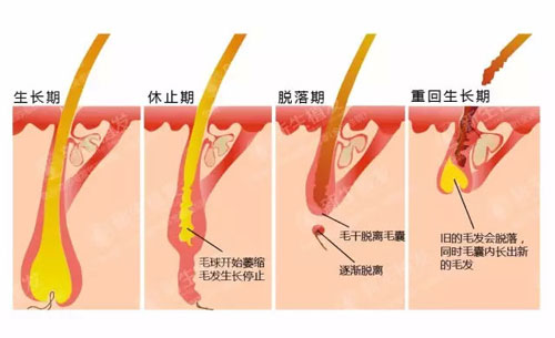 发际线种植