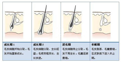 发际线种植